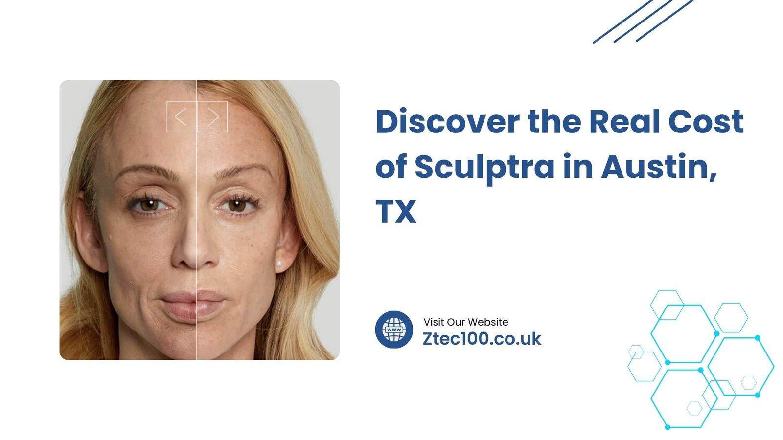 Cost of Sculptra in Austin 1 Discover the Real Cost of Sculptra in Austin, TX