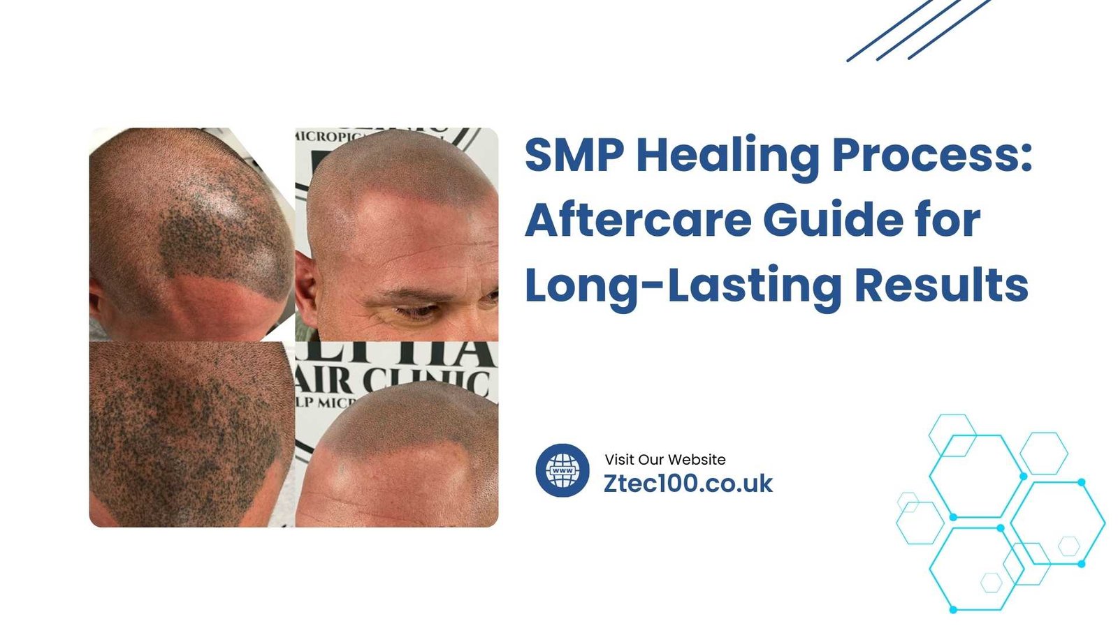 SMP Healing Process The SMP Healing Process: Your Complete Aftercare Guide for Long-Lasting Results