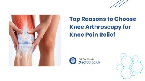 Top Reasons to Choose Knee Arthroscopy for Knee Pain Relief 10 Top Reasons to Choose Knee Arthroscopy for Knee Pain Relief Top Reasons to Choose Knee Arthroscopy for Knee Pain Relief
