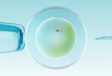 Choosing Fertility Treatment: Why IVF Abroad is an Excellent Option 6 IVF Abroad