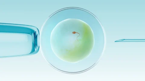 Choosing Fertility Treatment: Why IVF Abroad is an Excellent Option 17 IVF Abroad
